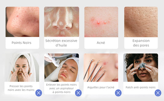 Épurateur de Peau Visage Ultrasonique